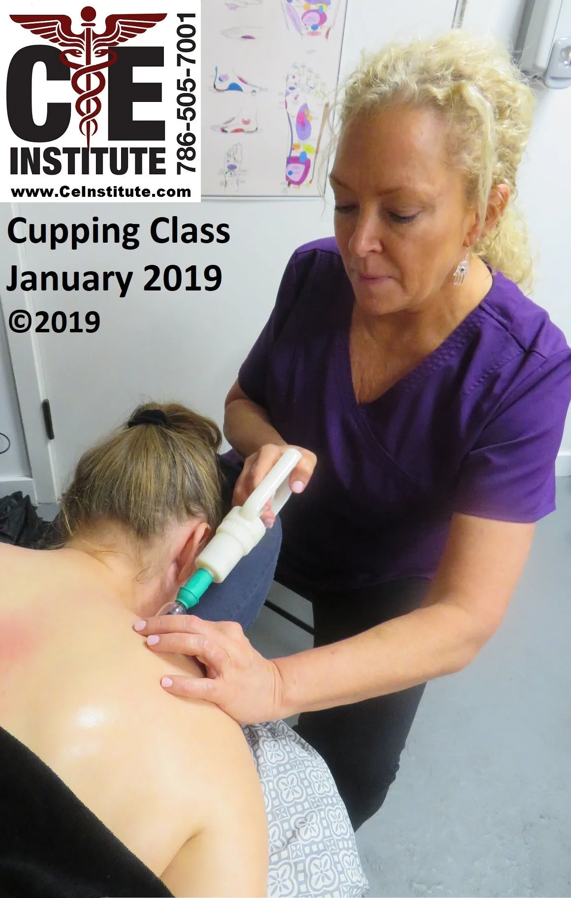 18 CE Hour Advanced Myofascial Cupping (Computer-Based Live Interactive Webinar)