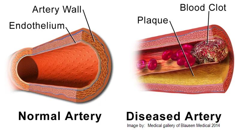 Self-paced Online Home Study 12 CE Hour Advanced Geriatric and Seniors Massage and Bodywork