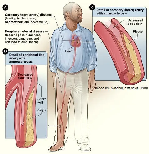 Self-paced Online Home Study 12 CE Hour Advanced Geriatric and Seniors Massage and Bodywork